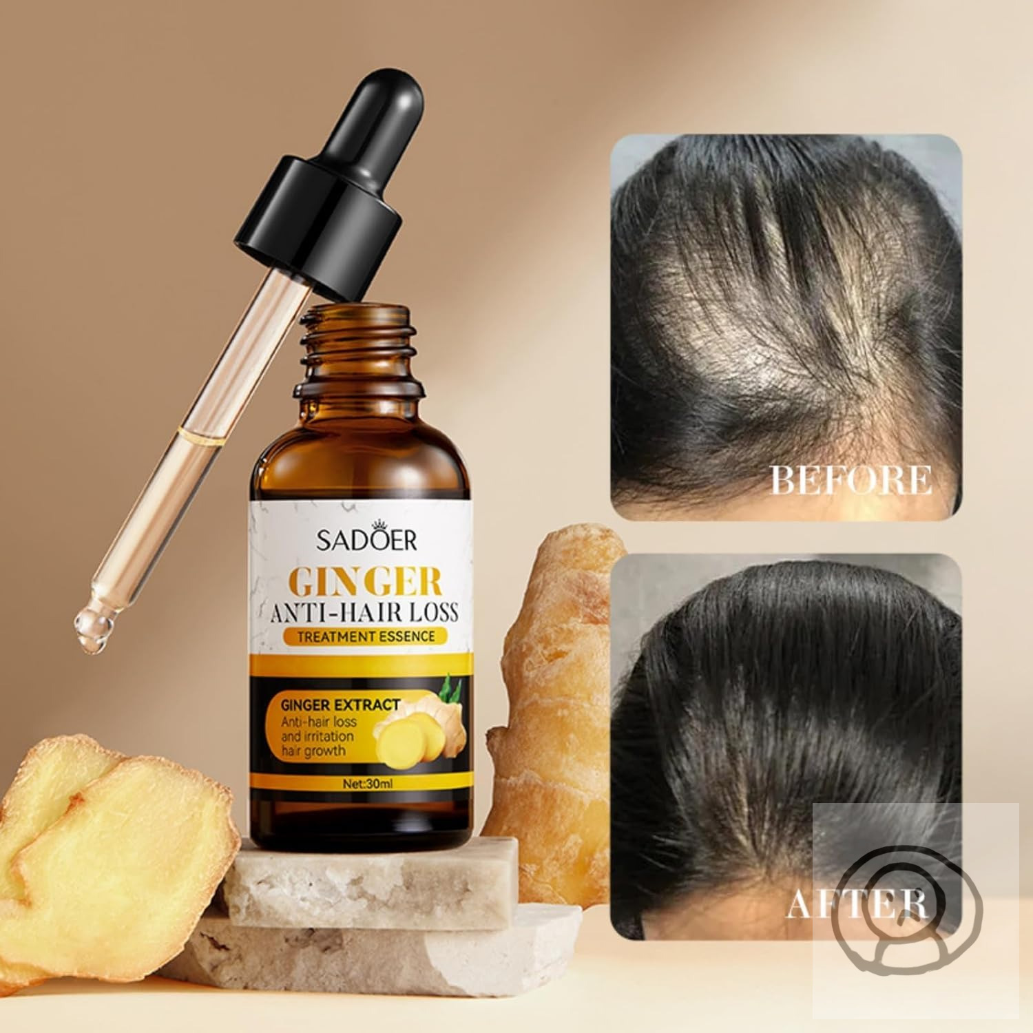 SADOER 生姜護髮精華液 Serums 改善乾枯防脱髮