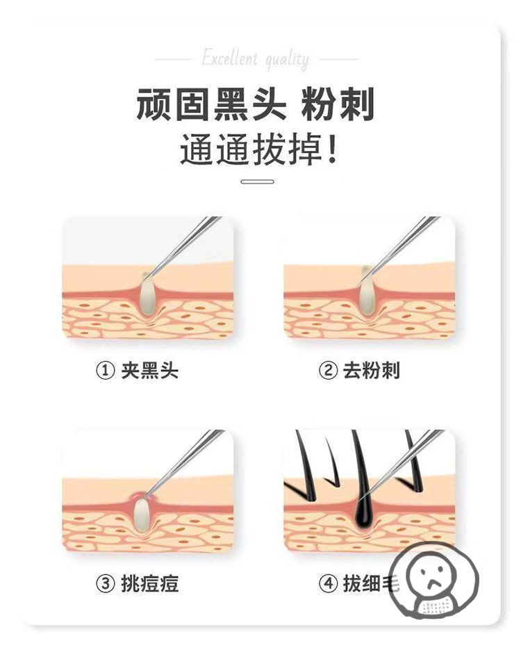 超細黑頭粉刺夾套裝 美容院同款精準深層清潔毛孔 擠痘工具